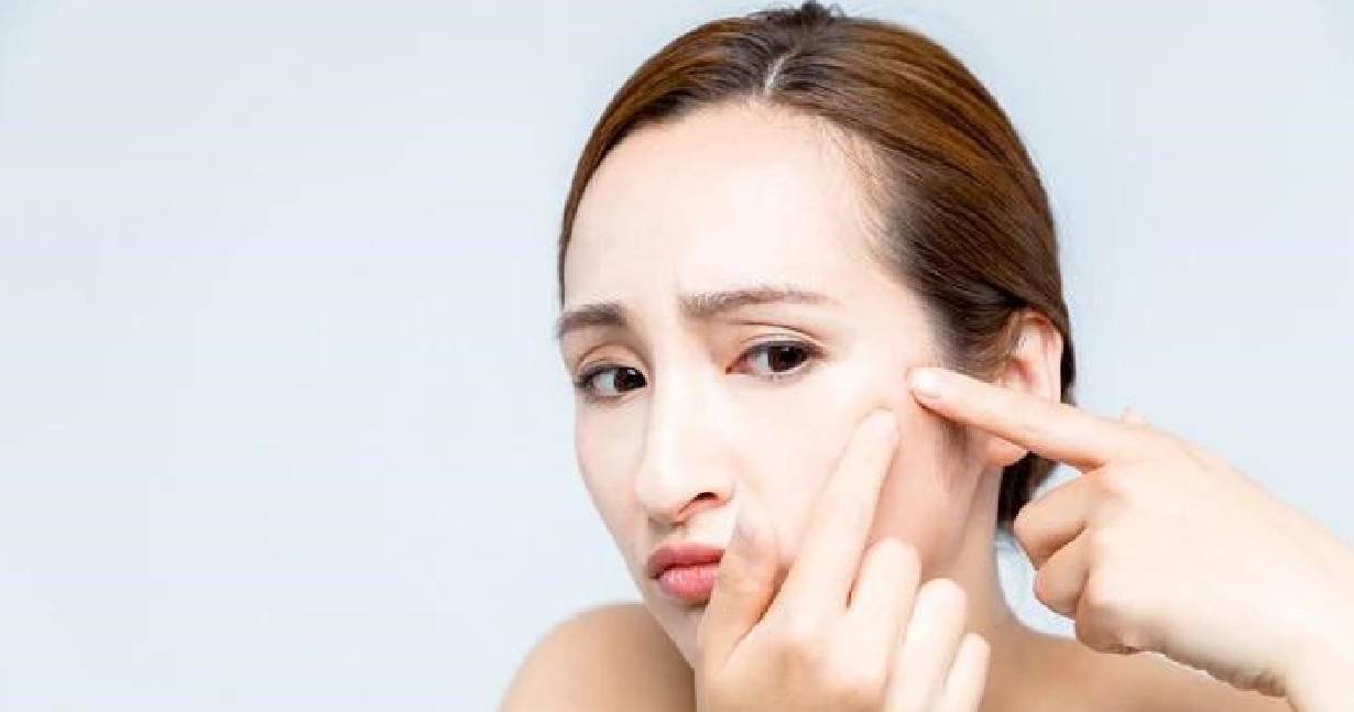 Can Boils Be Caused by Stress?