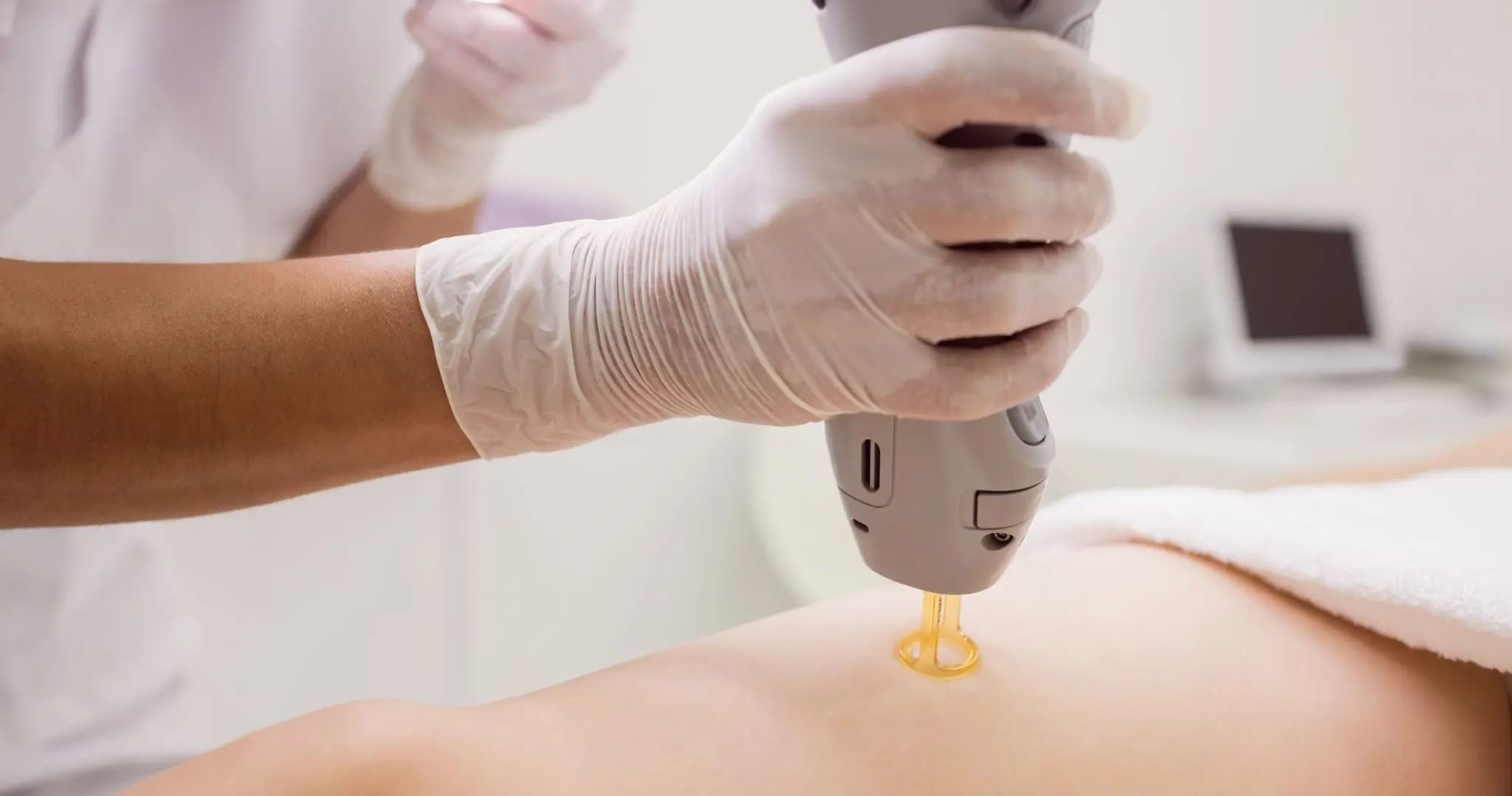 What’s Laser Hair Removal Patch Test & Why It’s Important