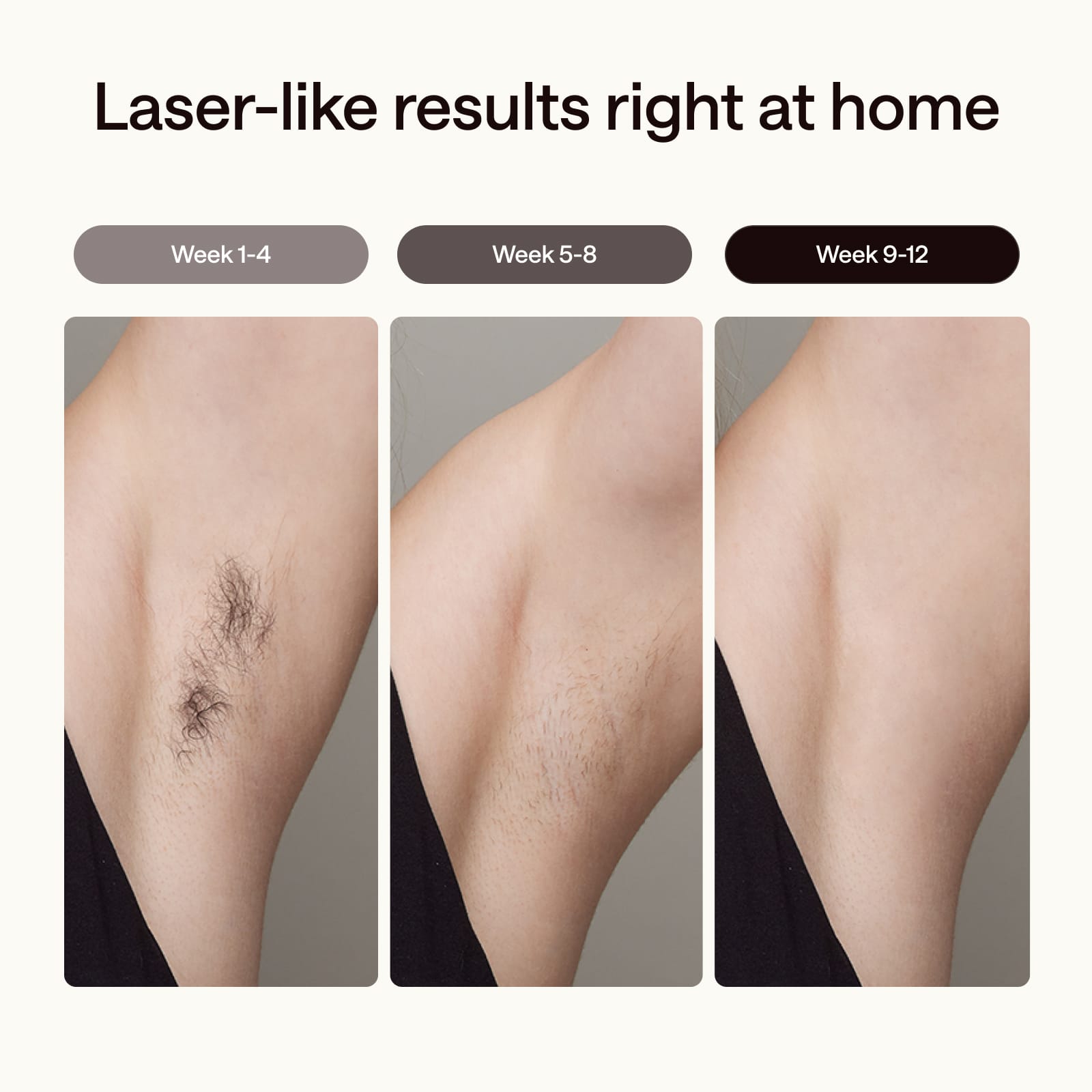 Ulike Air 3 Deluxe IPL Hair Removal