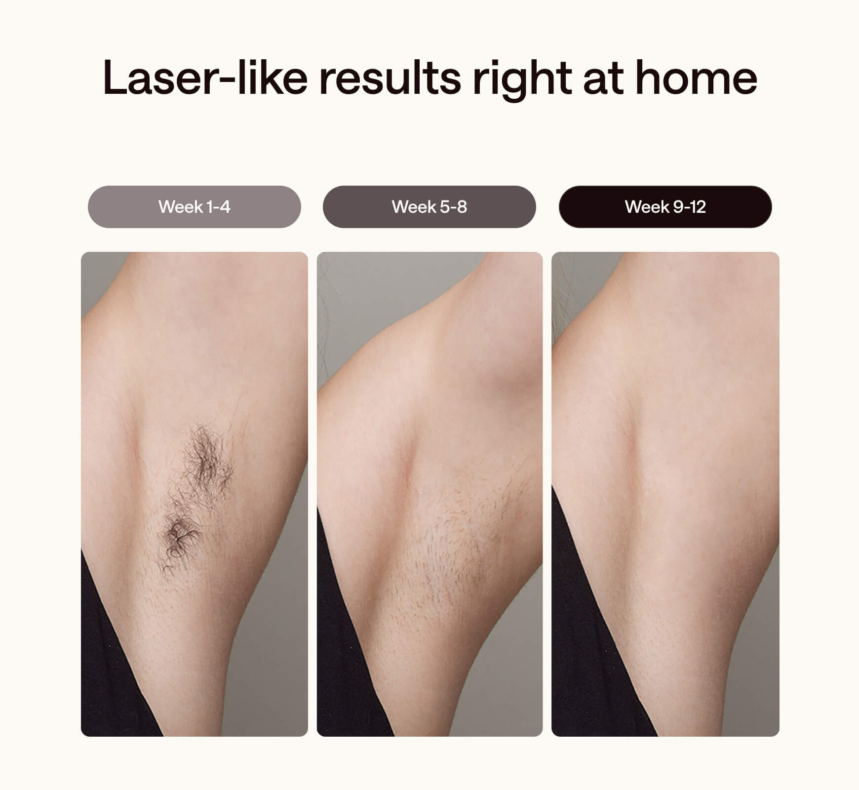 Ulike Air 3 IPL Hair Removal