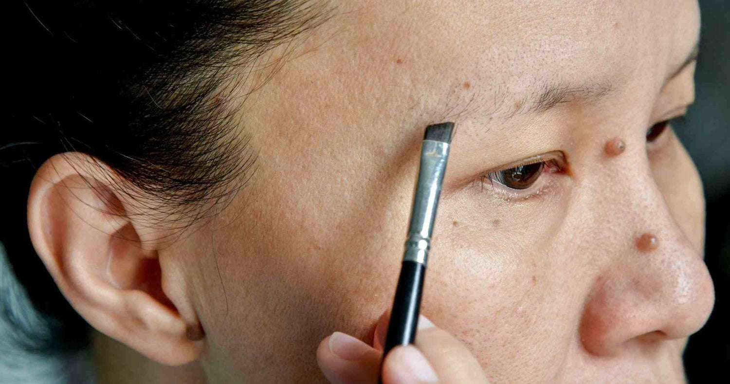 Best Guide to Thinning Eyebrows Concerns & Treatments