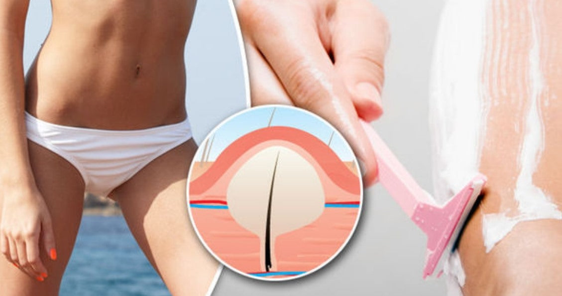 Can You Use Hair Removal Cream on Pubic Hair?