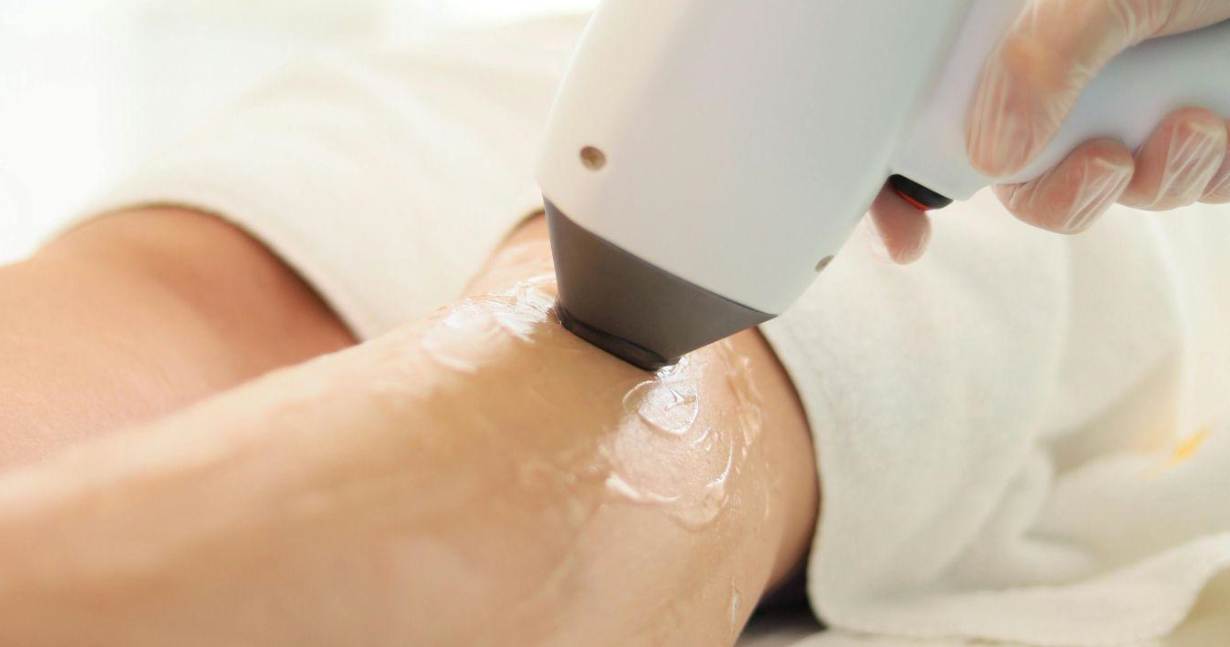 How Long Between Laser Hair Removal Sessions Do You Wait?