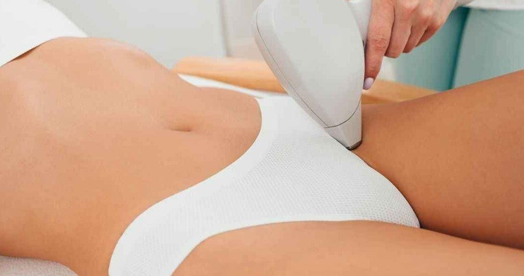 What is Hollywood Laser Hair Removal? Your Complete Guide