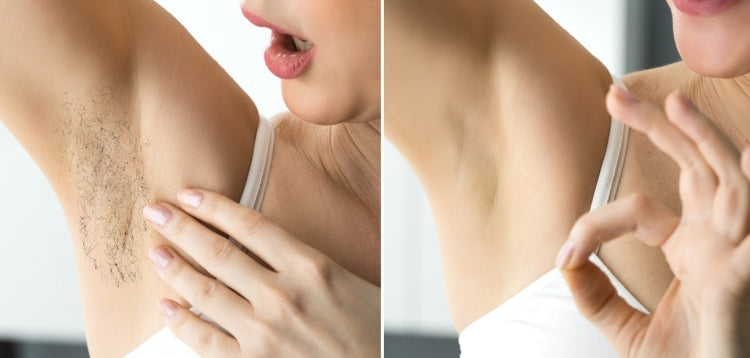 At-Home Laser Hair Removal on Different Phases of Hair Growth Cycle