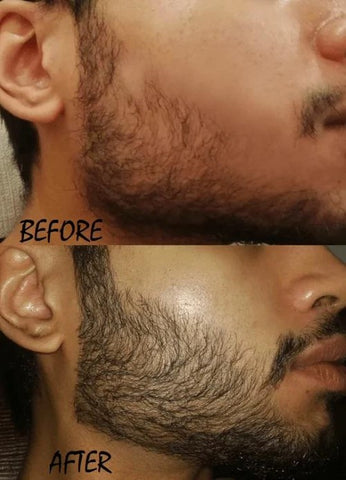 Beard Oil Before and After