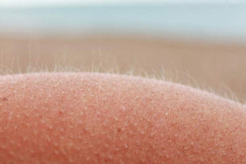 Peach Fuzz