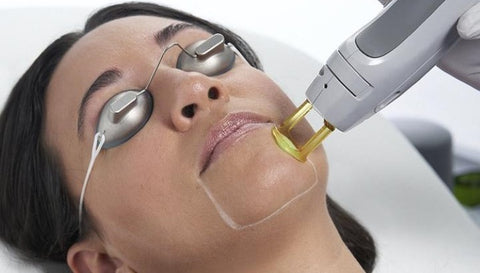 Electrolysis Chin Hair