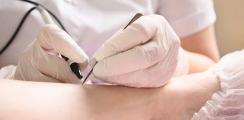 Electrolysis