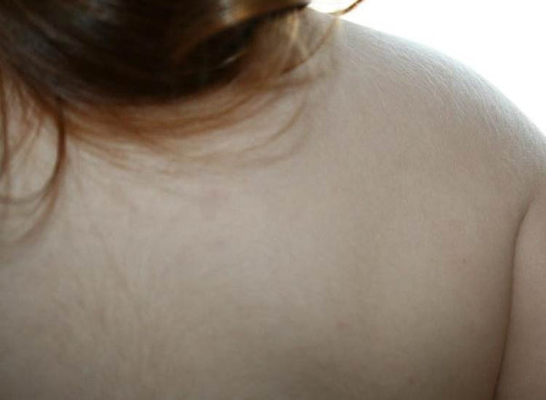 Getting Rid of Hair on the Back With Lifestyle Changes