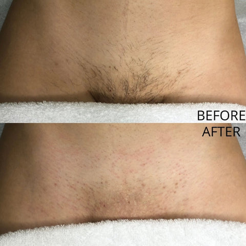 Hollywood Wax Before and After