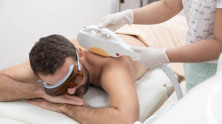 How To Remove Back Hair With Laser Hair Removal