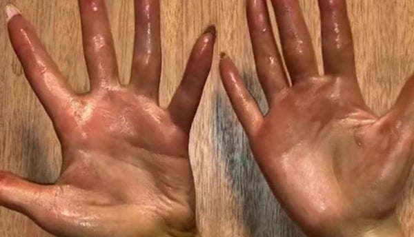 How to Remove Fake Tan From the Hands Quickly