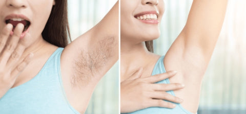 Is Shaving the Best Solution