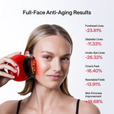 JMOON-by-Ulike-M12-Max-full-face-anti-aging-results