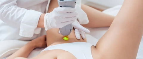 Laser Hair Removal