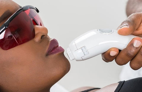 Laser Hair Removal Chin