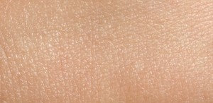 Normal Skin