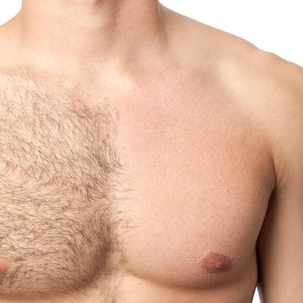 Other Hair Removal Options for Bum Hair