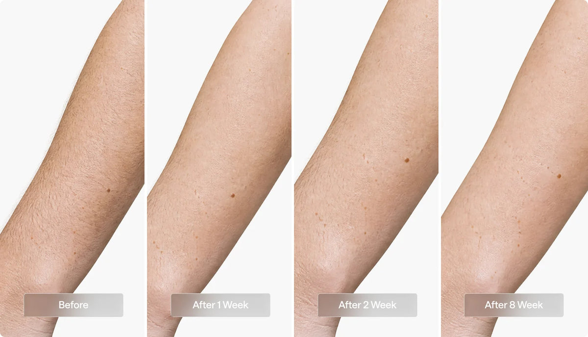 Arms