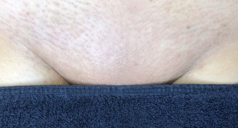 Preventive measures to take to avoid problems after Brazilian wax