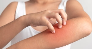 Sensitive Skin