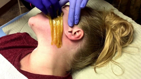 Sugaring Chin Hair