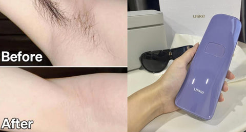 Ulike Air3 before and after