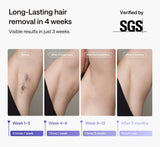 Ulike_Air_3_visible_results_in_just_3_weeks