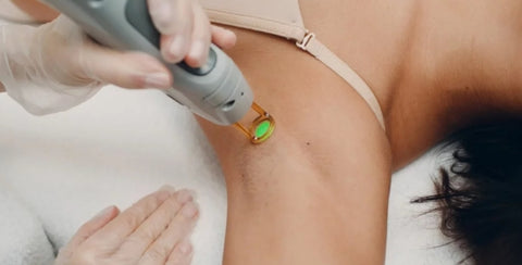 What Factors Affect The Cost of Laser Hair Removal In London