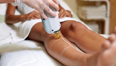 What Is a Patch Test for Laser Hair     Removal