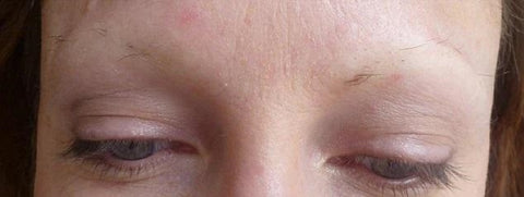 Why Are My Eyebrows Thinning