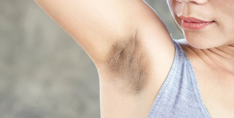 Why Are My Underarms Dark