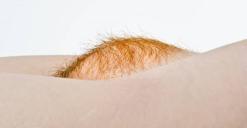 Why Do Gingers Have Ginger Pubes