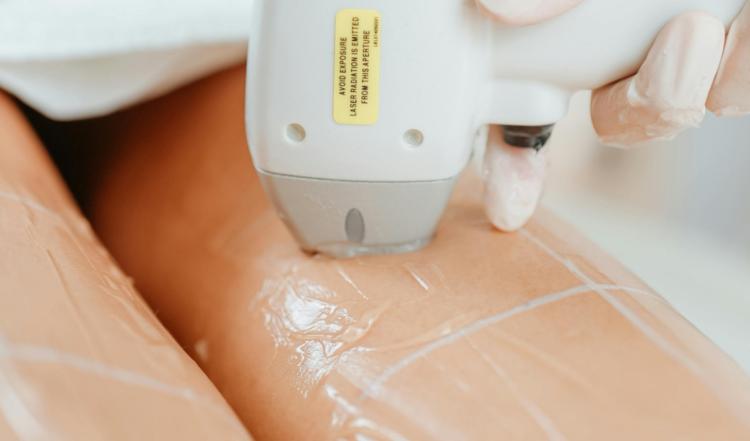 Will I Really Get Permanent Hair Removal Results From IPL Treatments