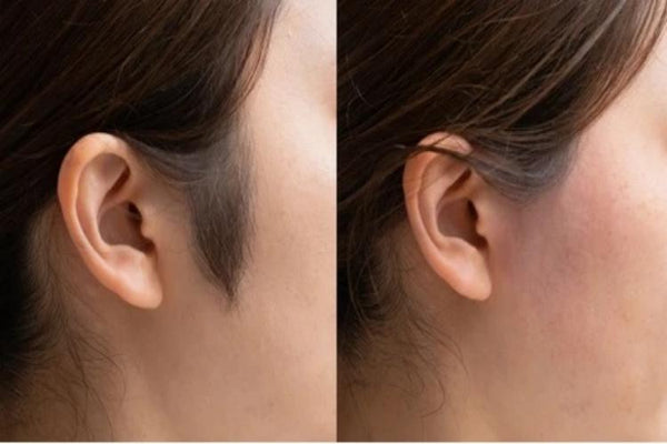 Women’s Sideburns Before & After