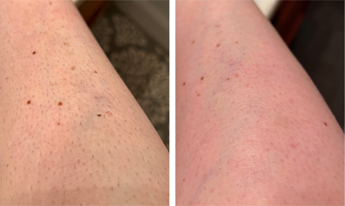 Before and After Photos