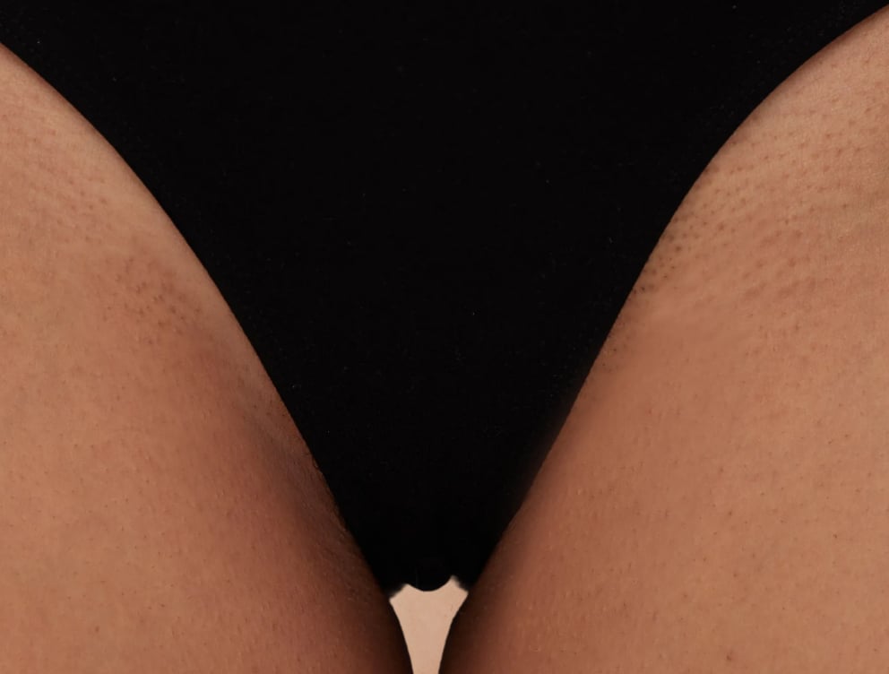 uk-homepage-bikini-hair-removal-after